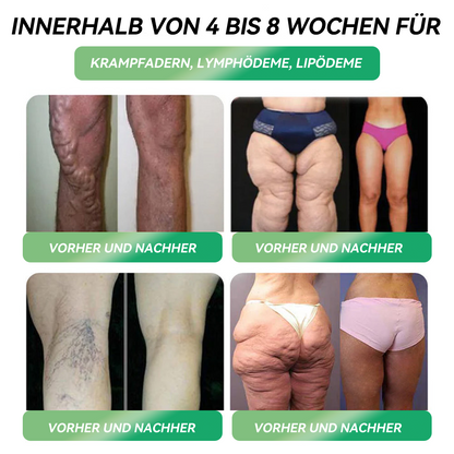 HHVB 30% Rabatt für eine begrenzte Zeit. Viele Anwender entscheiden sich für den Kauf von 6 Boxen auf einmal (für 60 Tage Anwendung), da dies nicht nur die Ergebnisse stabilisiert, sondern auch ein günstiges Kombi-Angebot darstellt! 👍